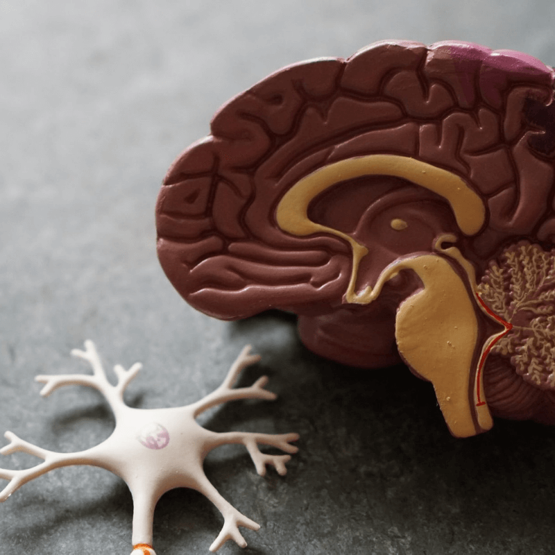 Brain activity